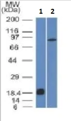 Western blot - Anti-E Cadherin antibody [CDH1/1525] (AB219332)