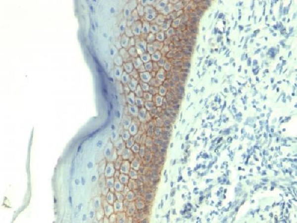 Immunohistochemistry (Formalin/PFA-fixed paraffin-embedded sections) - Anti-E Cadherin antibody [CDH1/1525] - BSA and Azide free (AB269767), expandable thumbnail