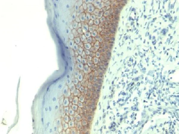Immunohistochemistry (Formalin/PFA-fixed paraffin-embedded sections) - Anti-E Cadherin antibody [CDH1/1525] - BSA and Azide free (AB269767)