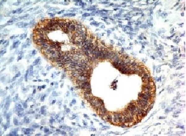 Immunohistochemistry (Formalin/PFA-fixed paraffin-embedded sections) - Anti-E Cadherin antibody [CDH1/1525] - BSA and Azide free (ab269767), expandable thumbnail