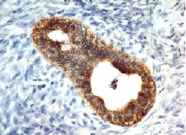 Immunohistochemistry (Formalin/PFA-fixed paraffin-embedded sections) - Anti-E Cadherin antibody [CDH1/1525] - BSA and Azide free (AB269767)