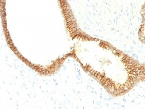 Immunohistochemistry (Formalin/PFA-fixed paraffin-embedded sections) - Anti-E Cadherin antibody [CDH1/1525] - BSA and Azide free (AB269767), expandable thumbnail