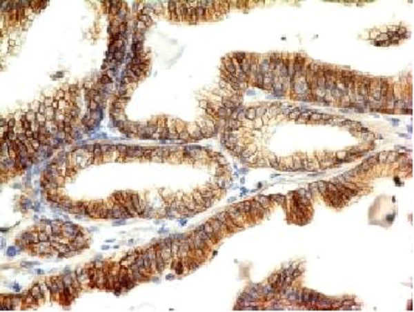 Immunohistochemistry (Formalin/PFA-fixed paraffin-embedded sections) - Anti-E Cadherin antibody [CDH1/1525] - BSA and Azide free (AB269767)