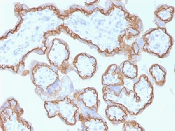 Immunohistochemistry (Formalin/PFA-fixed paraffin-embedded sections) - Anti-E Cadherin antibody [CDH1/1525] - BSA and Azide free (AB269767), expandable thumbnail