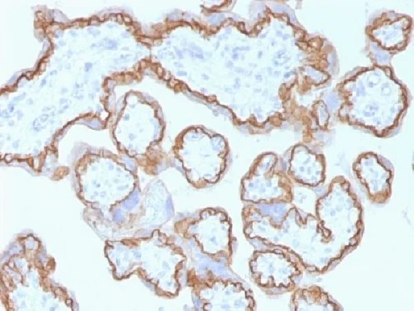 Immunohistochemistry (Formalin/PFA-fixed paraffin-embedded sections) - Anti-E Cadherin antibody [CDH1/1525] - BSA and Azide free (AB269767)