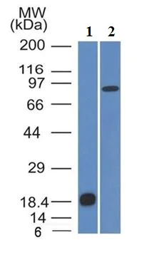 Western blot - Anti-E Cadherin antibody [CDH1/1525] - BSA and Azide free (AB269767)