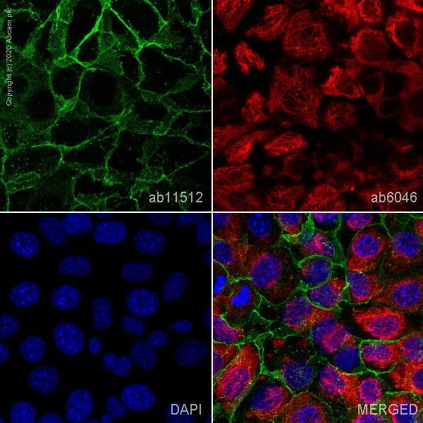 Immunocytochemistry/ Immunofluorescence - Anti-E Cadherin antibody [DECMA-1] - Intercellular Junction Marker (AB11512)