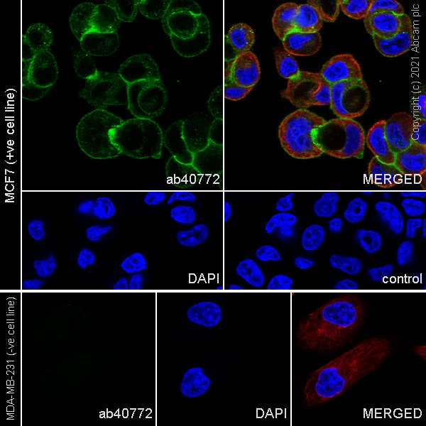 Immunocytochemistry/ Immunofluorescence - Anti-E Cadherin antibody [EP700Y] - BSA and Azide free (AB256580)