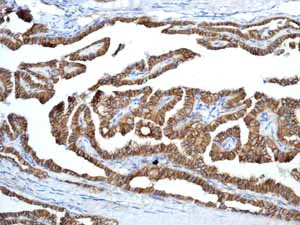 Immunohistochemistry (Formalin/PFA-fixed paraffin-embedded sections) - Anti-E Cadherin antibody [EP700Y] - BSA and Azide free (AB256580)