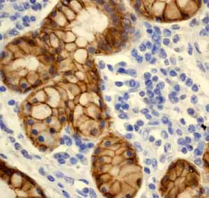 Immunohistochemistry (Formalin/PFA-fixed paraffin-embedded sections) - Anti-E Cadherin antibody [EP700Y] - BSA and Azide free (AB256580)