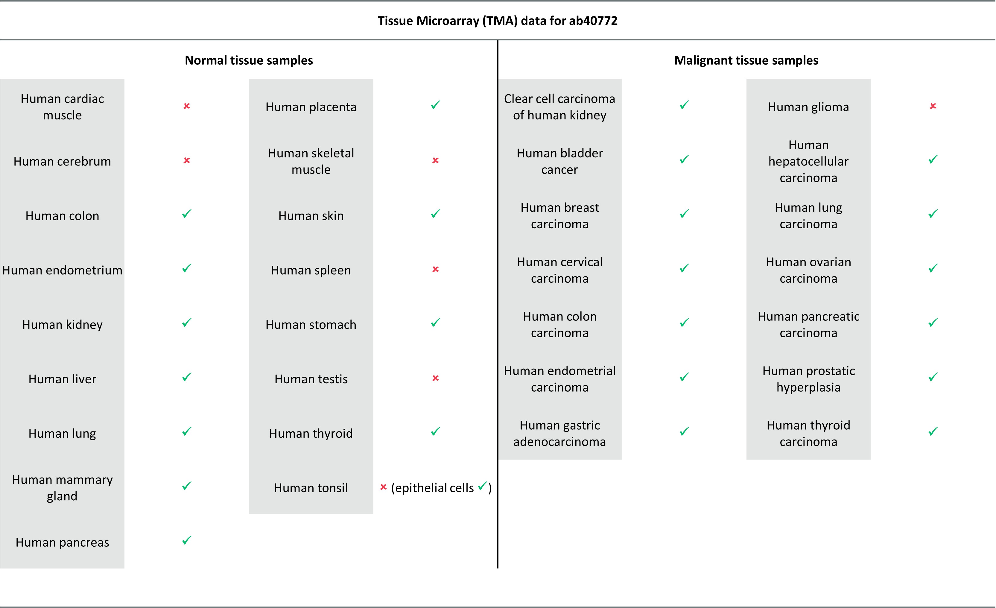 Immunohistochemistry (Formalin/PFA-fixed paraffin-embedded sections) - Anti-E Cadherin antibody [EP700Y] - BSA and Azide free (ab256580), expandable thumbnail