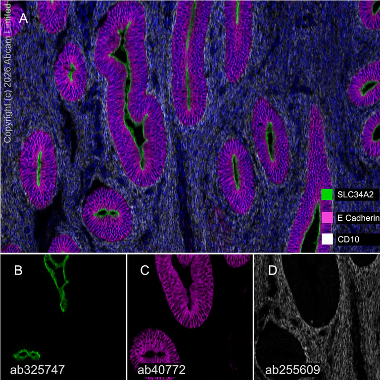 Multiplex immunohistochemistry - Anti-E Cadherin antibody [EP700Y] - BSA and Azide free (AB256580)
