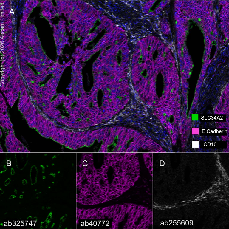 Multiplex immunohistochemistry - Anti-E Cadherin antibody [EP700Y] - BSA and Azide free (AB256580)