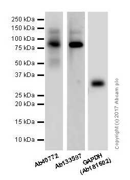 Western blot - Anti-E Cadherin antibody [EP700Y] - BSA and Azide free (AB256580)