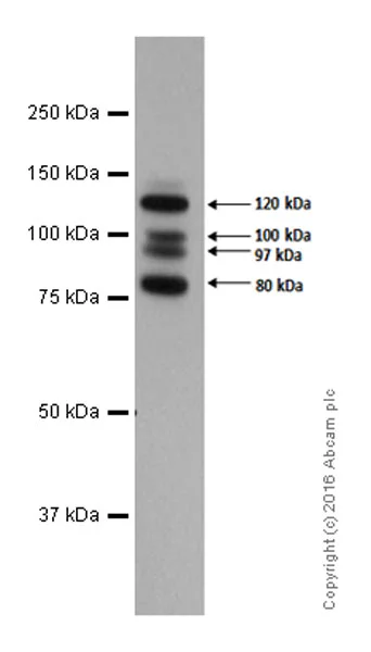Western blot - Anti-E Cadherin antibody [EP700Y] - BSA and Azide free (AB256580)