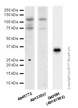 Western blot - Anti-E Cadherin antibody [EP700Y] - BSA and Azide free (AB256580)