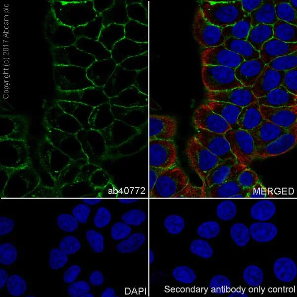 Immunocytochemistry/ Immunofluorescence - Anti-E Cadherin antibody [EP700Y] - Intercellular Junction Marker (AB40772)