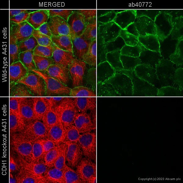 Immunocytochemistry/ Immunofluorescence - Anti-E Cadherin antibody [EP700Y] - Intercellular Junction Marker (AB40772)