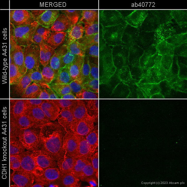 Immunocytochemistry/ Immunofluorescence - Anti-E Cadherin antibody [EP700Y] - Intercellular Junction Marker (AB40772)