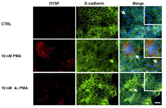 Immunocytochemistry/ Immunofluorescence - Anti-E Cadherin antibody [EP700Y] - Intercellular Junction Marker (AB40772)