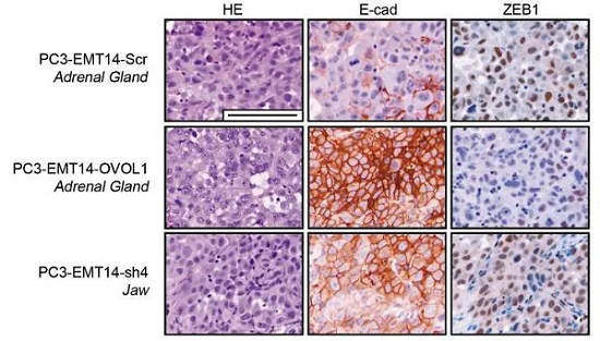 Immunohistochemistry (Formalin/PFA-fixed paraffin-embedded sections) - Anti-E Cadherin antibody [EP700Y] - Intercellular Junction Marker (AB40772)