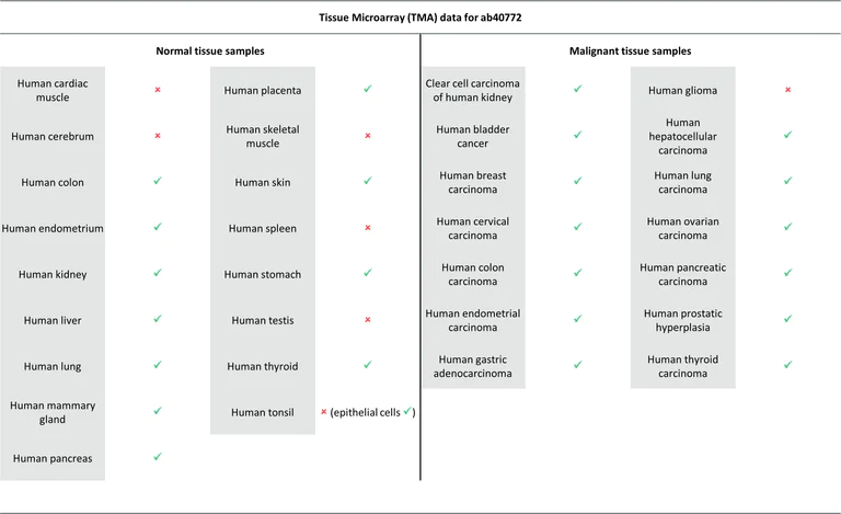 Immunohistochemistry (Formalin/PFA-fixed paraffin-embedded sections) - Anti-E Cadherin antibody [EP700Y] - Intercellular Junction Marker (AB40772)