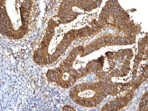 Immunohistochemistry (Formalin/PFA-fixed paraffin-embedded sections) - Anti-E Cadherin antibody [EP700Y] - Intercellular Junction Marker (AB40772)