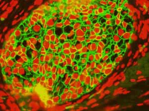 Immunohistochemistry (Formalin/PFA-fixed paraffin-embedded sections) - Anti-E Cadherin antibody [EP700Y] - Intercellular Junction Marker (AB40772)