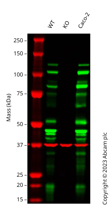 Western blot - Anti-E Cadherin antibody [EP700Y] - Intercellular Junction Marker (AB40772)