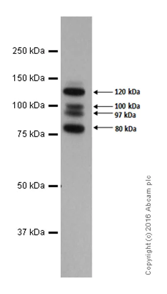 Western blot - Anti-E Cadherin antibody [EP700Y] - Intercellular Junction Marker (AB40772)