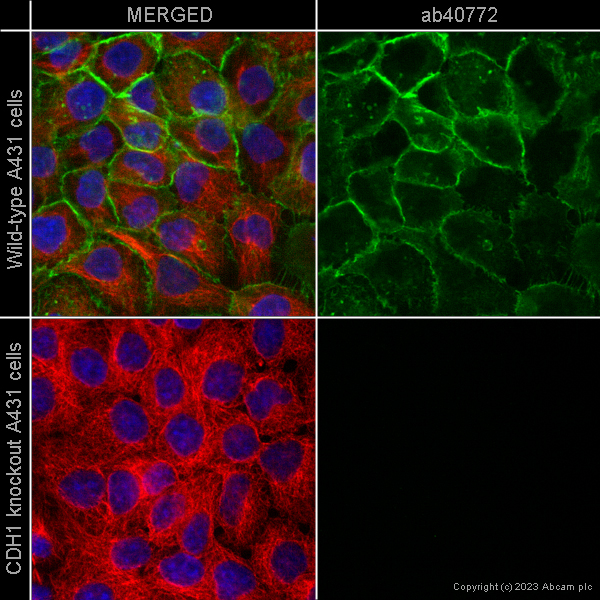 Immunocytochemistry/ Immunofluorescence - Anti-E Cadherin antibody [EP700Y] - Low endotoxin, Azide free (ab201499), expandable thumbnail