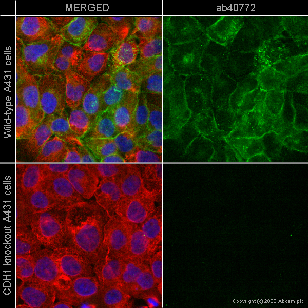 Immunocytochemistry/ Immunofluorescence - Anti-E Cadherin antibody [EP700Y] - Low endotoxin, Azide free (ab201499), expandable thumbnail