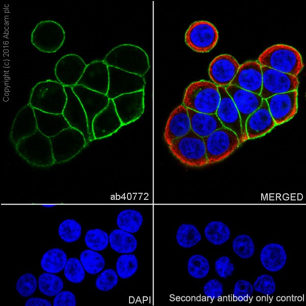 Immunocytochemistry/ Immunofluorescence - Anti-E Cadherin antibody [EP700Y] - Low endotoxin, Azide free (AB201499), expandable thumbnail