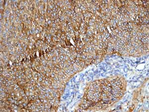 Immunohistochemistry (Formalin/PFA-fixed paraffin-embedded sections) - Anti-E Cadherin antibody [EP700Y] - Low endotoxin, Azide free (ab201499), expandable thumbnail