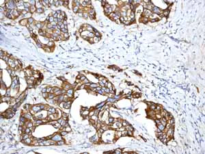 Immunohistochemistry (Formalin/PFA-fixed paraffin-embedded sections) - Anti-E Cadherin antibody [EP700Y] - Low endotoxin, Azide free (AB201499)