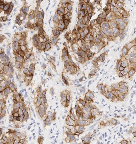 Immunohistochemistry (Formalin/PFA-fixed paraffin-embedded sections) - Anti-E Cadherin antibody [EP700Y] - Low endotoxin, Azide free (AB201499)