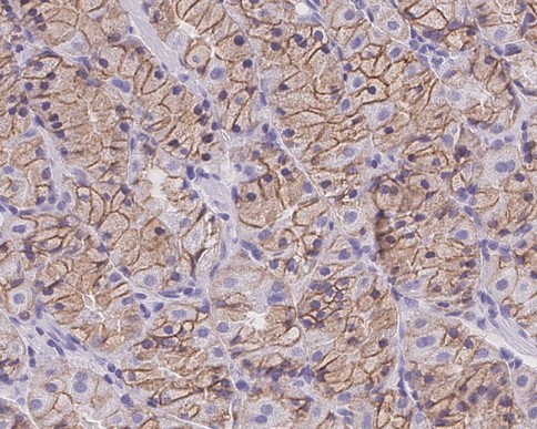 Immunohistochemistry (Formalin/PFA-fixed paraffin-embedded sections) - Anti-E Cadherin antibody [EP700Y] - Low endotoxin, Azide free (AB201499)