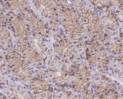 Immunohistochemistry (Formalin/PFA-fixed paraffin-embedded sections) - Anti-E Cadherin antibody [EP700Y] - Low endotoxin, Azide free (AB201499)