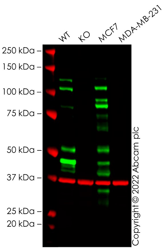 Western blot - Anti-E Cadherin antibody [EP700Y] - Low endotoxin, Azide free (ab201499), expandable thumbnail