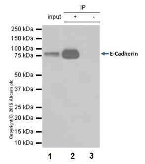 Immunoprecipitation - Anti-E Cadherin antibody [EPR16845-108] (AB181296), expandable thumbnail