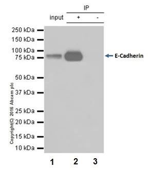 Immunoprecipitation - Anti-E Cadherin antibody [EPR16845-108] (AB181296)