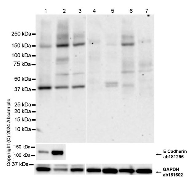 Western blot - Anti-E Cadherin antibody [EPR16845-108] (AB181296), expandable thumbnail