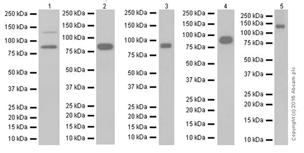 Western blot - Anti-E Cadherin antibody [EPR16845-34] (AB212059)