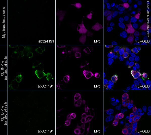 Immunocytochemistry/ Immunofluorescence - Anti-E Cadherin antibody [EPR30045-525] (AB324191), expandable thumbnail