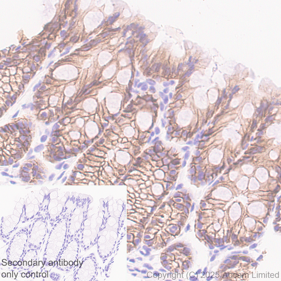 Immunohistochemistry (Formalin/PFA-fixed paraffin-embedded sections) - Anti-E Cadherin antibody [EPR30045-525] (AB324191), expandable thumbnail