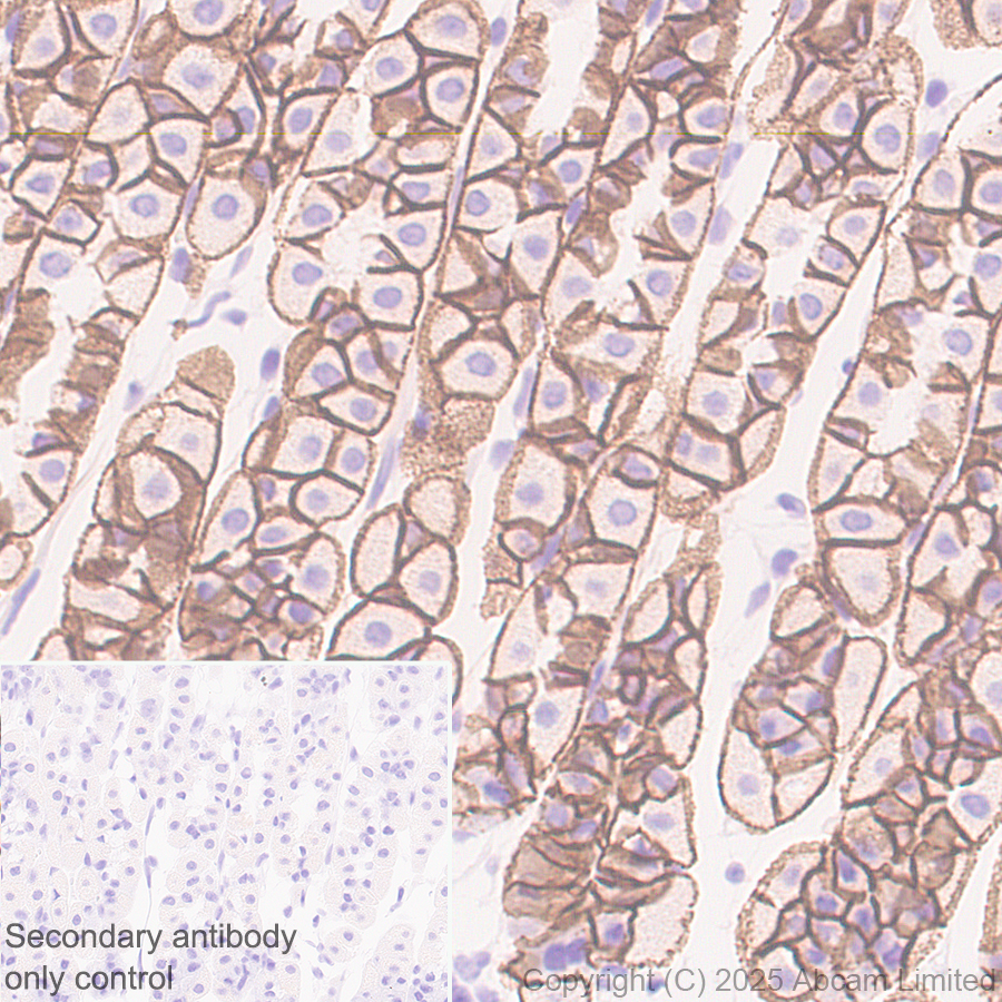 Immunohistochemistry (Formalin/PFA-fixed paraffin-embedded sections) - Anti-E Cadherin antibody [EPR30045-525] (AB324191), expandable thumbnail
