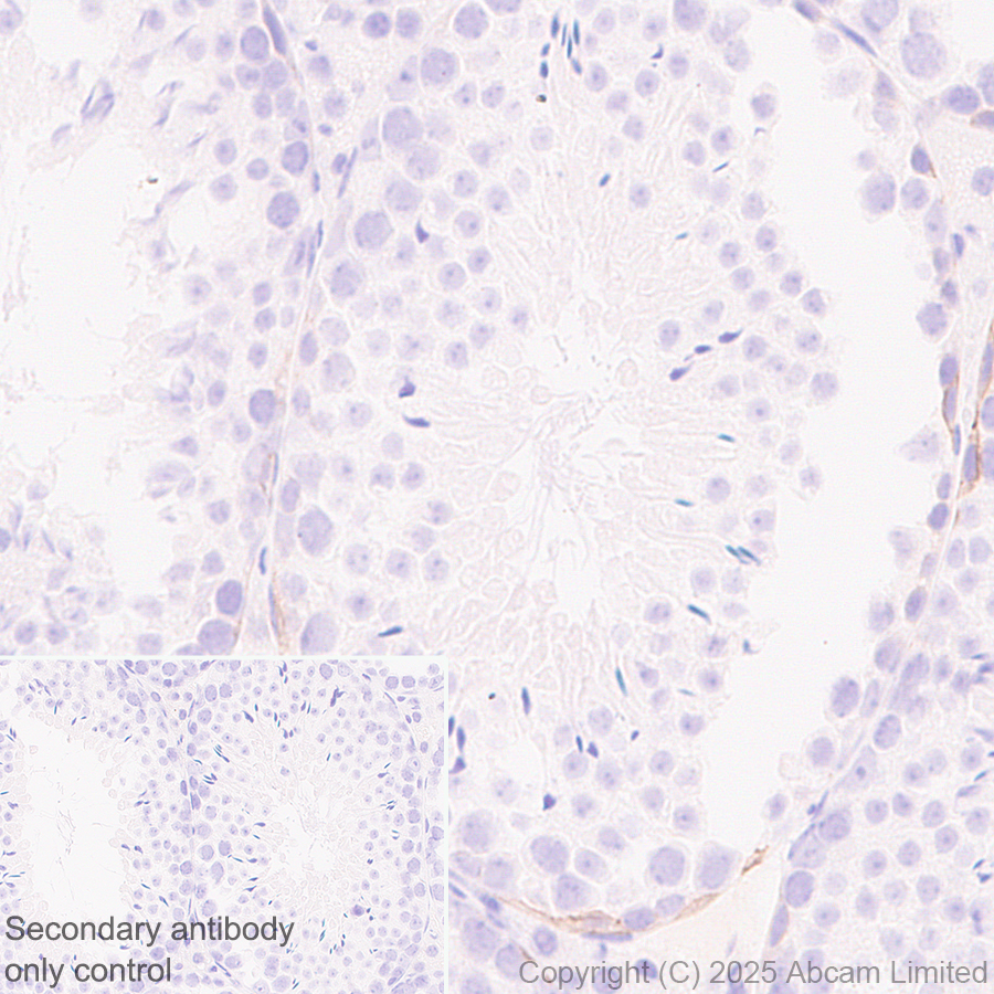 Immunohistochemistry (Formalin/PFA-fixed paraffin-embedded sections) - Anti-E Cadherin antibody [EPR30045-525] (ab324191), expandable thumbnail