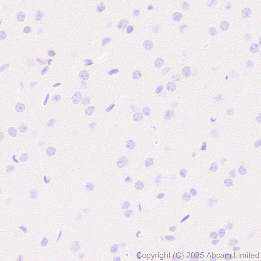 Immunohistochemistry (Formalin/PFA-fixed paraffin-embedded sections) - Anti-E Cadherin antibody [EPR30045-525] (ab324191), expandable thumbnail