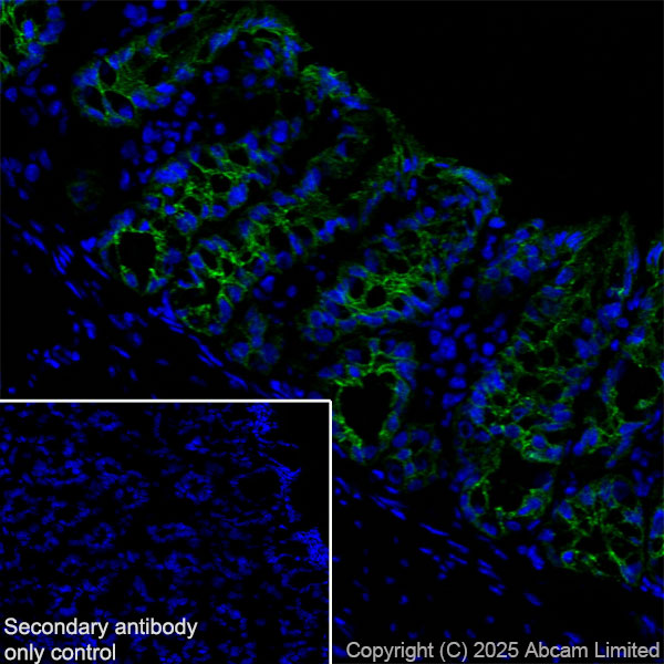 Immunohistochemistry (Frozen sections) - Anti-E Cadherin antibody [EPR30045-525] (ab324191), expandable thumbnail