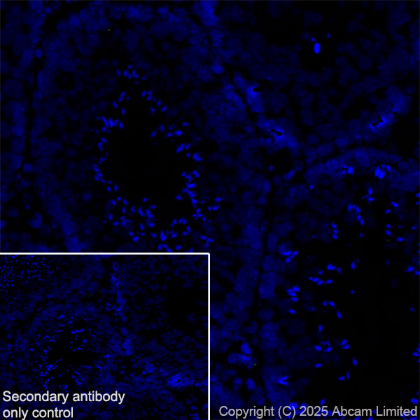 Immunohistochemistry (Frozen sections) - Anti-E Cadherin antibody [EPR30045-525] (AB324191), expandable thumbnail